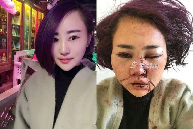 丽江打人毁容事件最新进展曝光